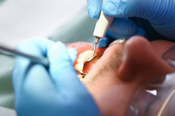 Best Emergency Treatment for Toothache in Madelia, MN