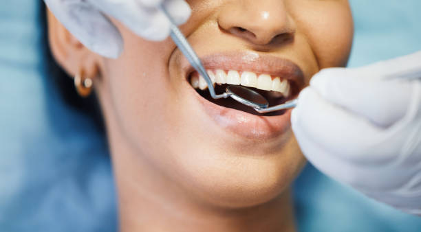 Best Emergency Root Canal Treatment in Madelia, MN